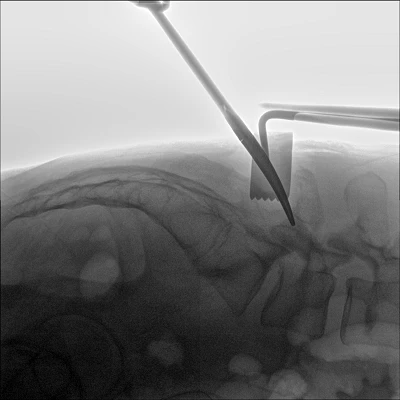 c arm x ray system c arm x ray system